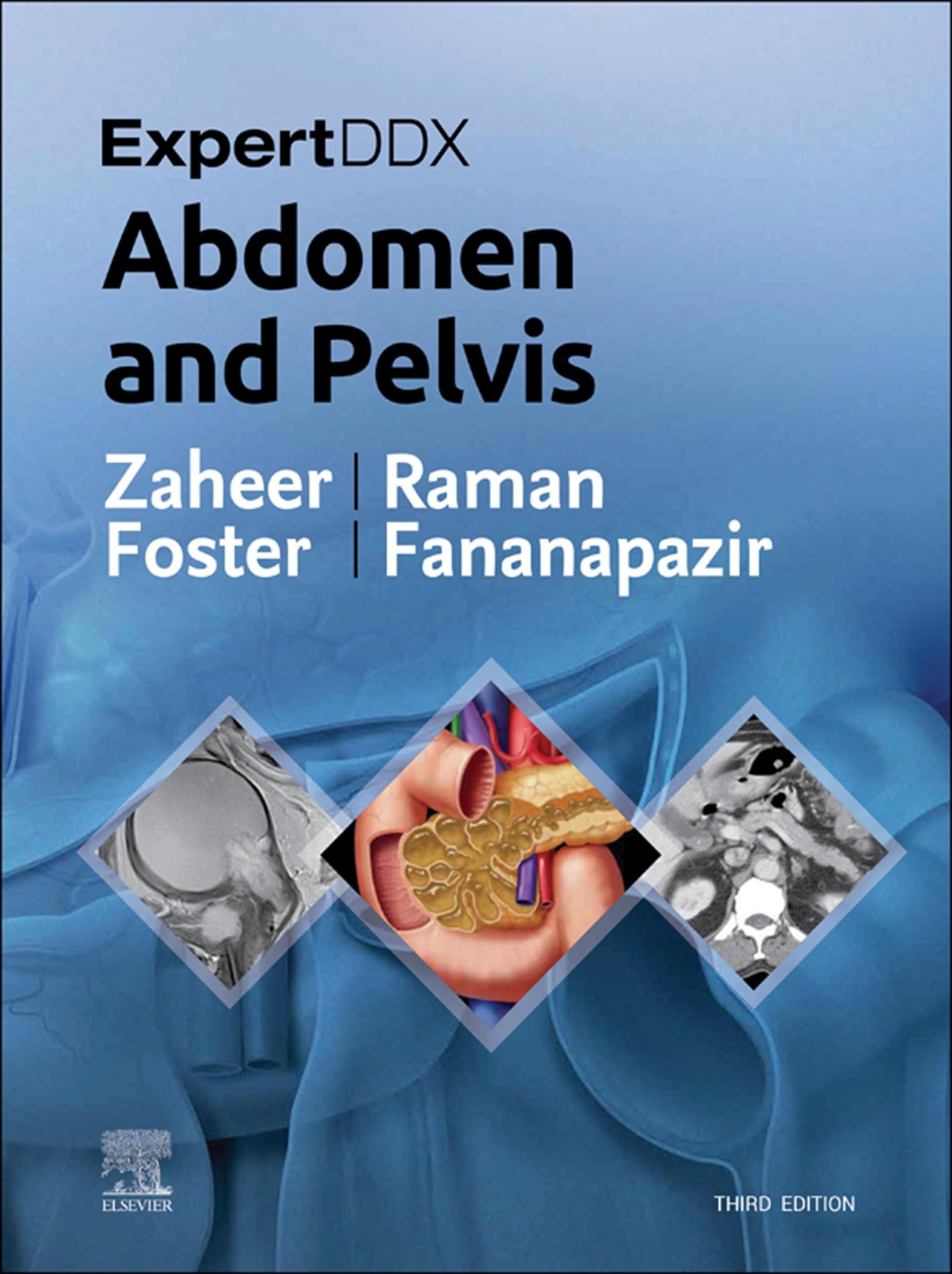 ExpertDDx: Abdomen and Pelvis - 3rd Edition