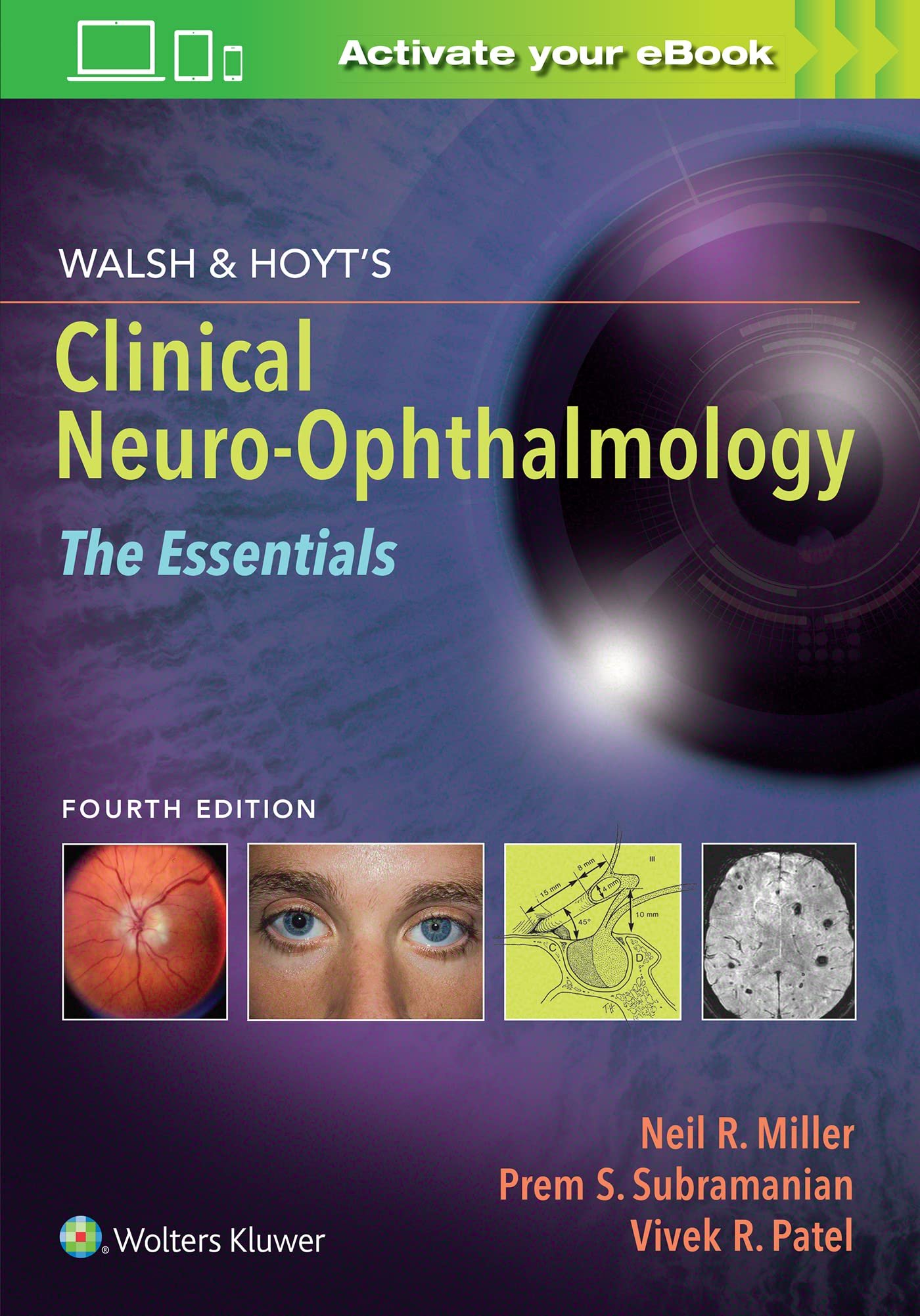 Walsh & Hoyt's Clinical Neuro-Ophthalmology: The Essentials - 4th Edition